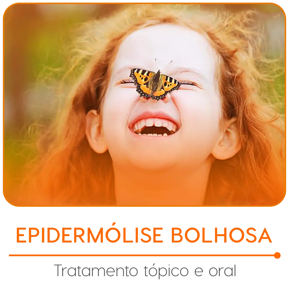 epidermolise-bolhosav2mobile copiar