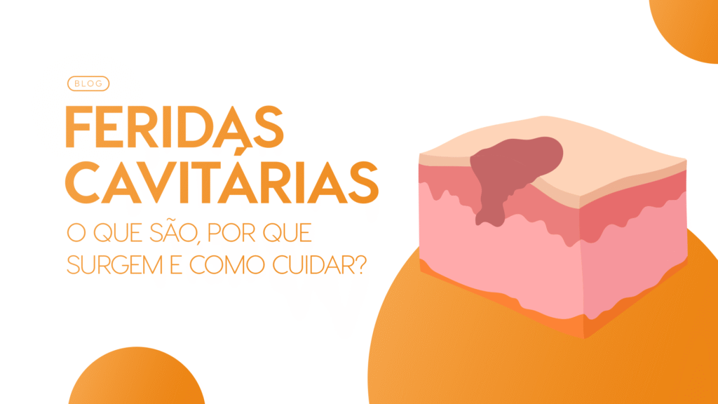 Feridas Cavitárias